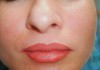 Фото Услуги косметолога! Татуаж, увеличение объёма губ, коррекция носогубных морщин