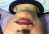 Фото Услуги косметолога! Татуаж, увеличение объёма губ, коррекция носогубных морщин