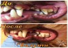 Фото Ультразвуковая чистка зубов собакам без наркоза