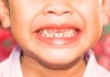 Детская стоматология с седацией