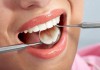 Фото Лечение зубов в Рязани