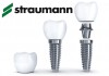 Установка импланта straumann для зубов